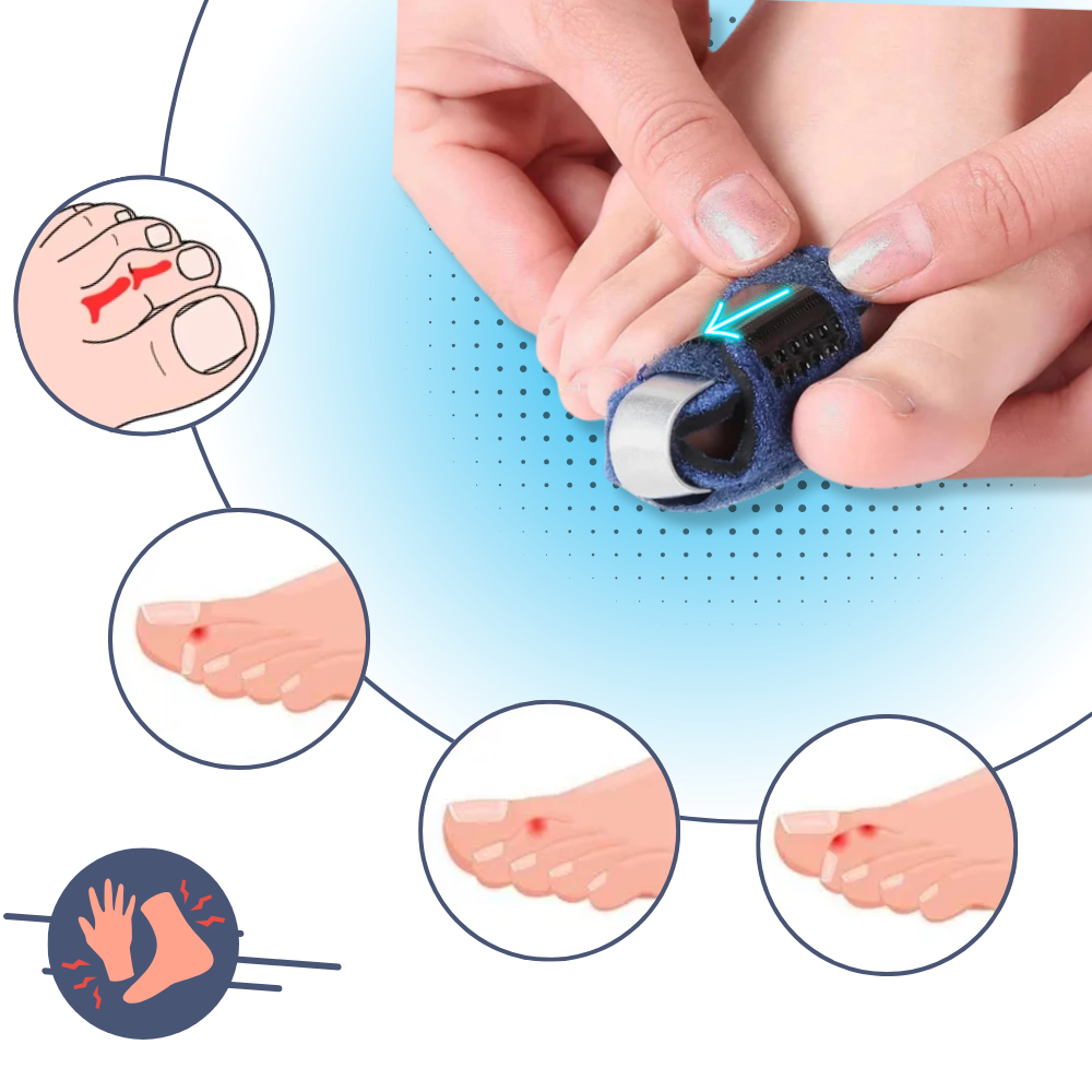 Alineador de dedos ajustable y discreto - Ozerty