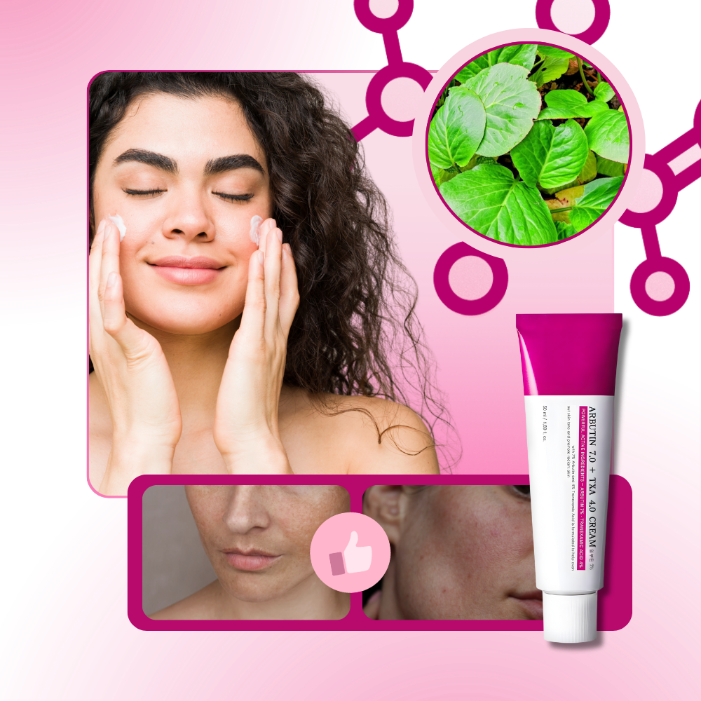 Crema tranexámica Even Skin - Ozerty