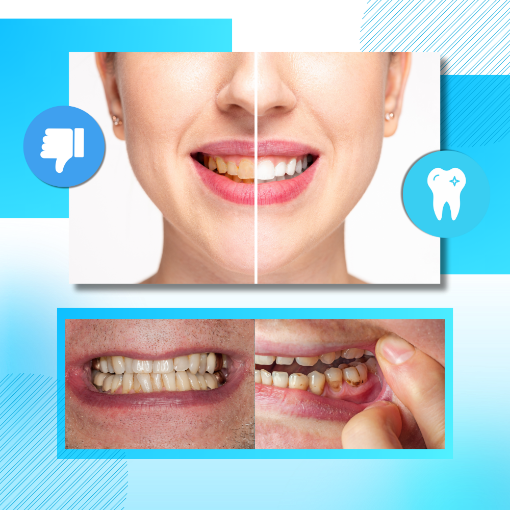 Tiras dentales de menta y carbón - Ozerty