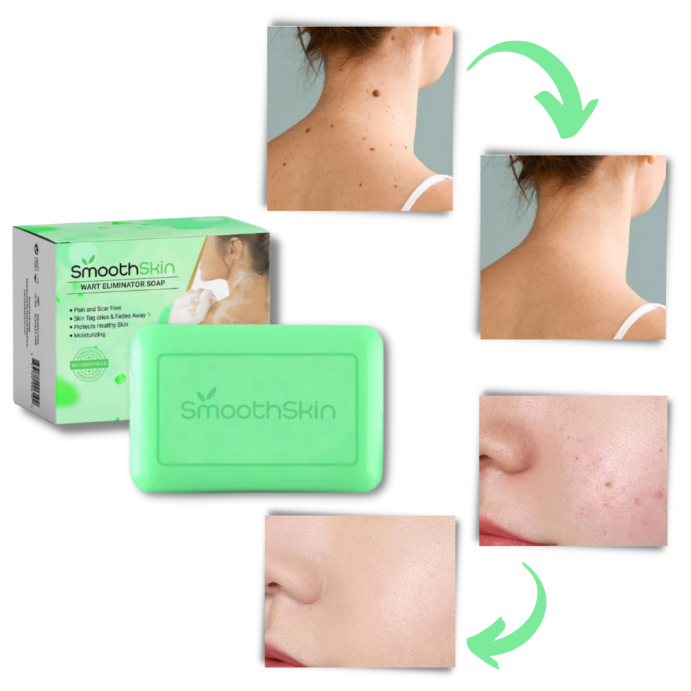 Jabón eliminador de verrugas hidratante y exfoliante
- Ozerty