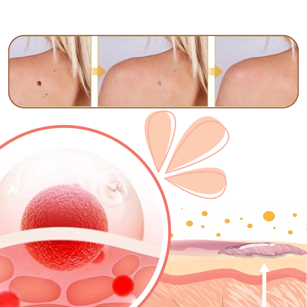 Spray inocuo anti imperfecciones cutáneas - Ozerty