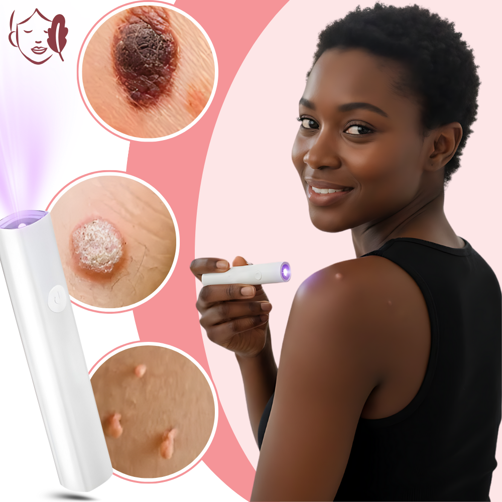 Lápiz láser cosmético Radiance - Ozerty