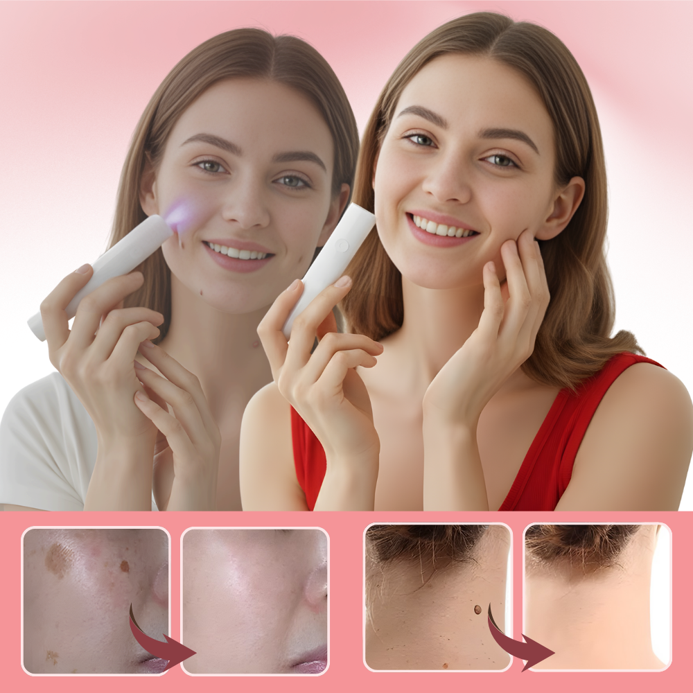 Lápiz láser cosmético Radiance - Ozerty