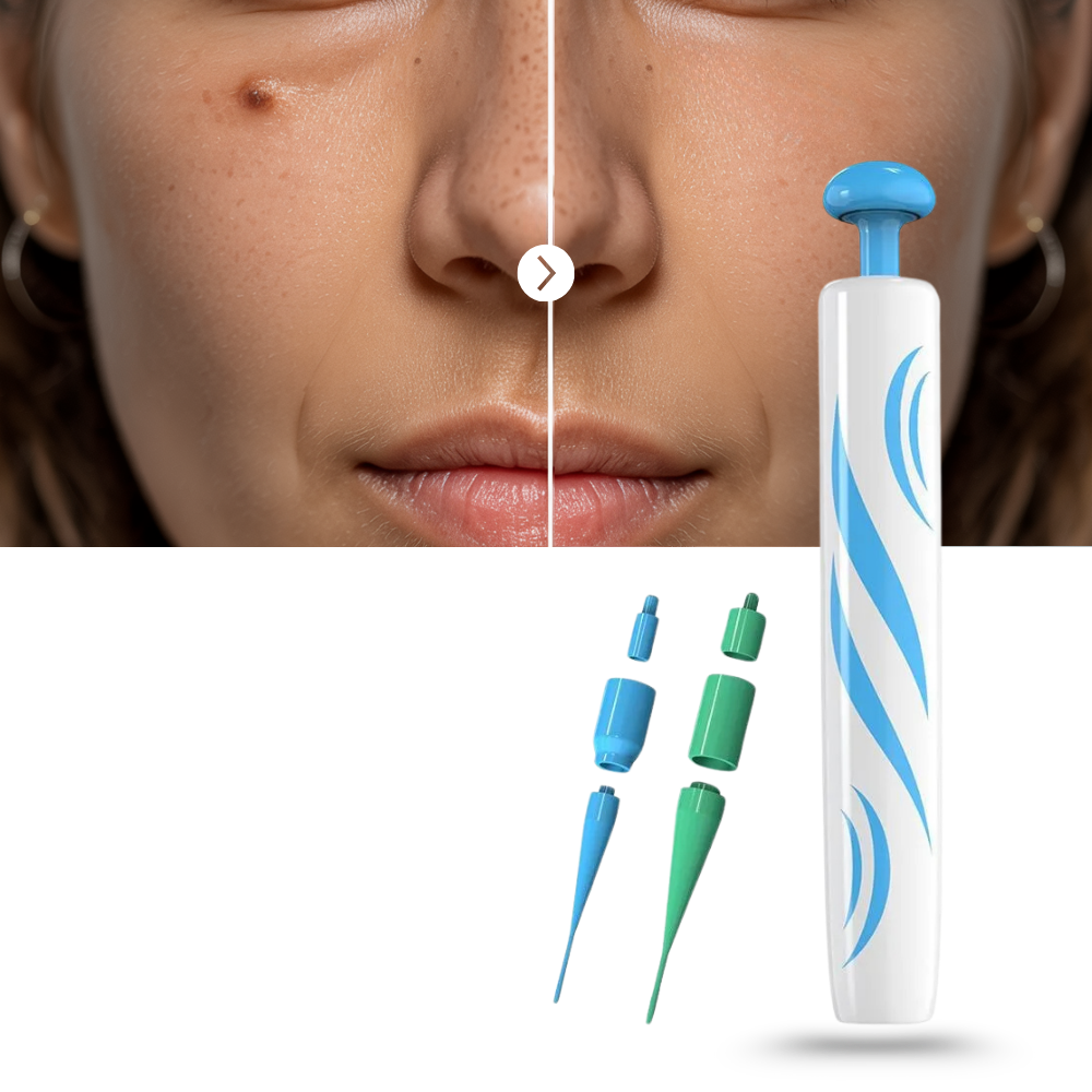 Eliminador de acrocordones - Ozerty