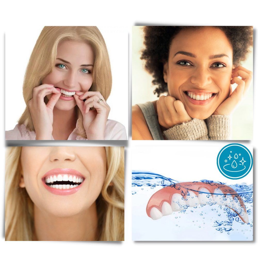 Carillas dentales Snap-On
- Ozerty