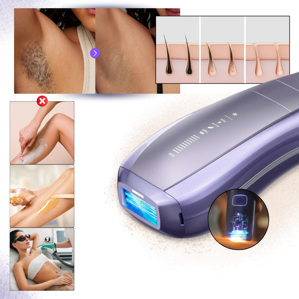 Depiladora IPL SkinSync - Ozerty