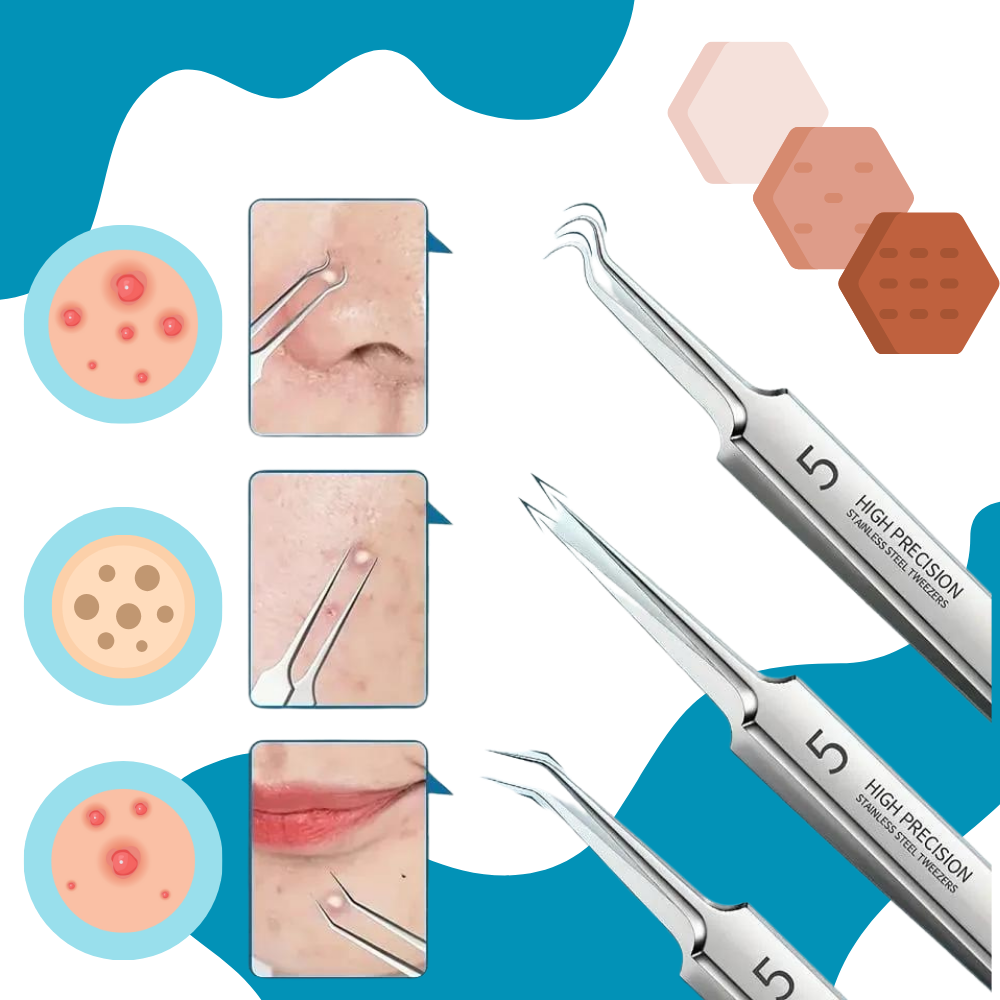 Pinzas faciales de alta precisión - Ozerty