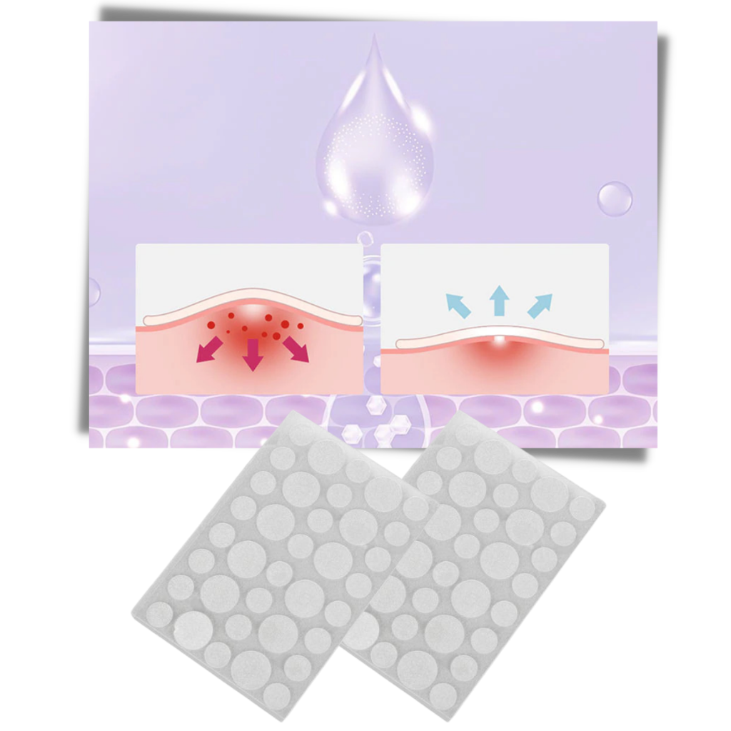 Paquete de 36 parches invisibles para el acné - Ozerty