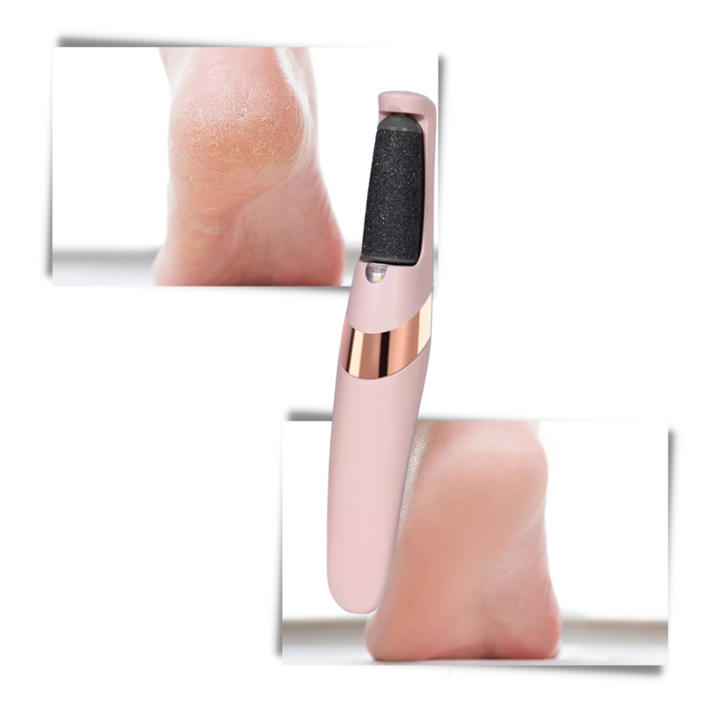 Quitacallos eléctrico - Ozerty