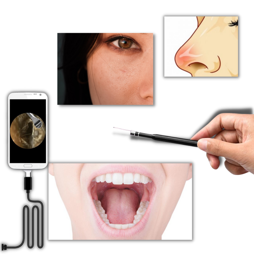 Cámara de oído 3 en 1 - Ozerty