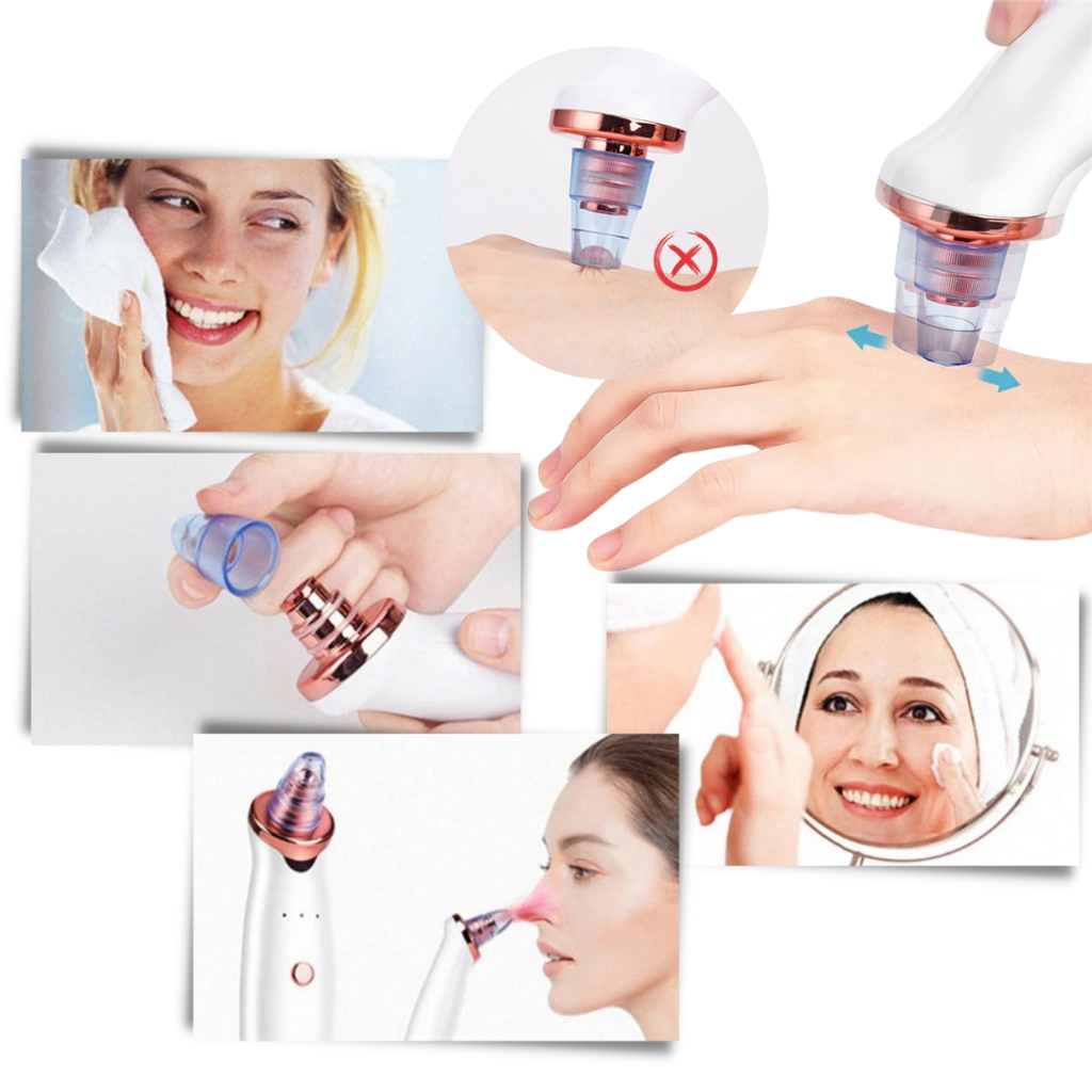 Aspirador para eliminar los puntos negros - Ozerty