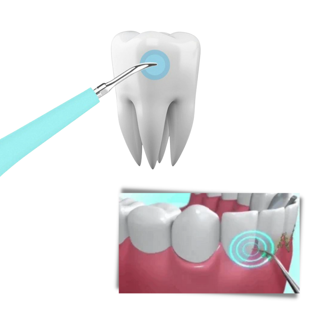 Máquina de limpieza profunda del sarro dental - Ozerty
