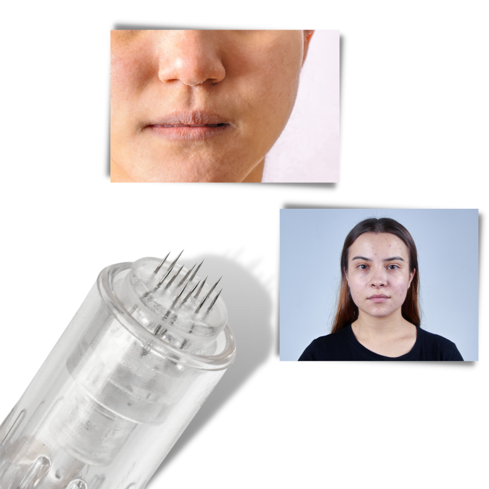 Pluma de microagujas dérmicas - Ozerty