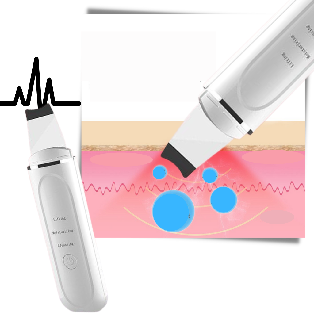 Exfoliante facial ultrasónico de limpieza profunda - Ozerty