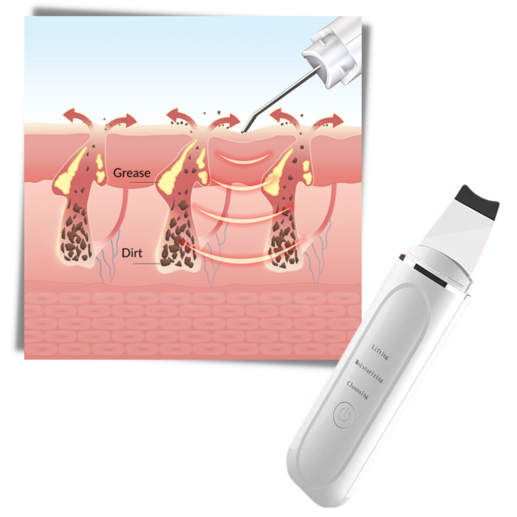 Exfoliante facial ultrasónico de limpieza profunda - Ozerty