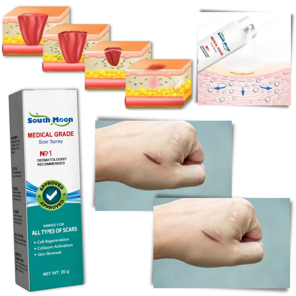 Tratamiento de eliminación de cicatrices en formato espray
- Ozerty