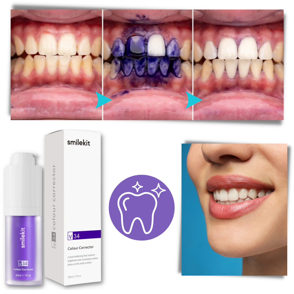Blanqueador dental púrpura

 - Ozerty