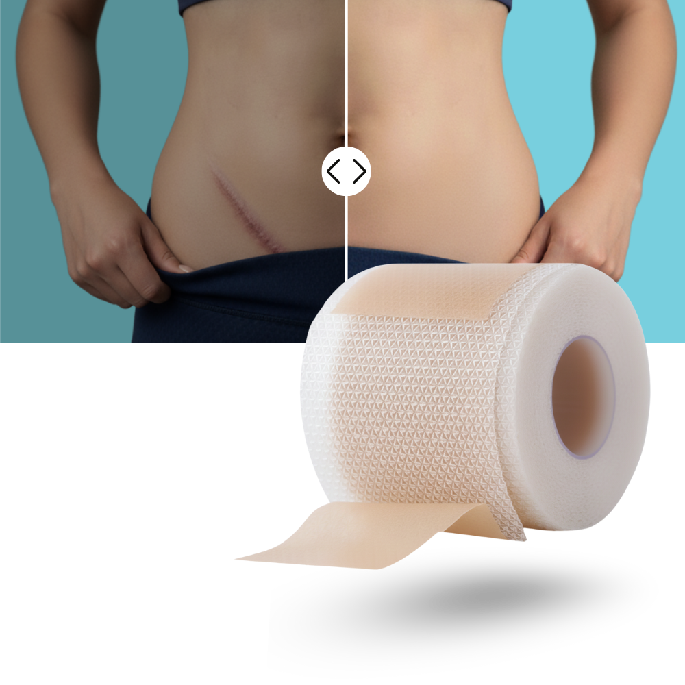 Parche de silicona hialurónica para cicatrices