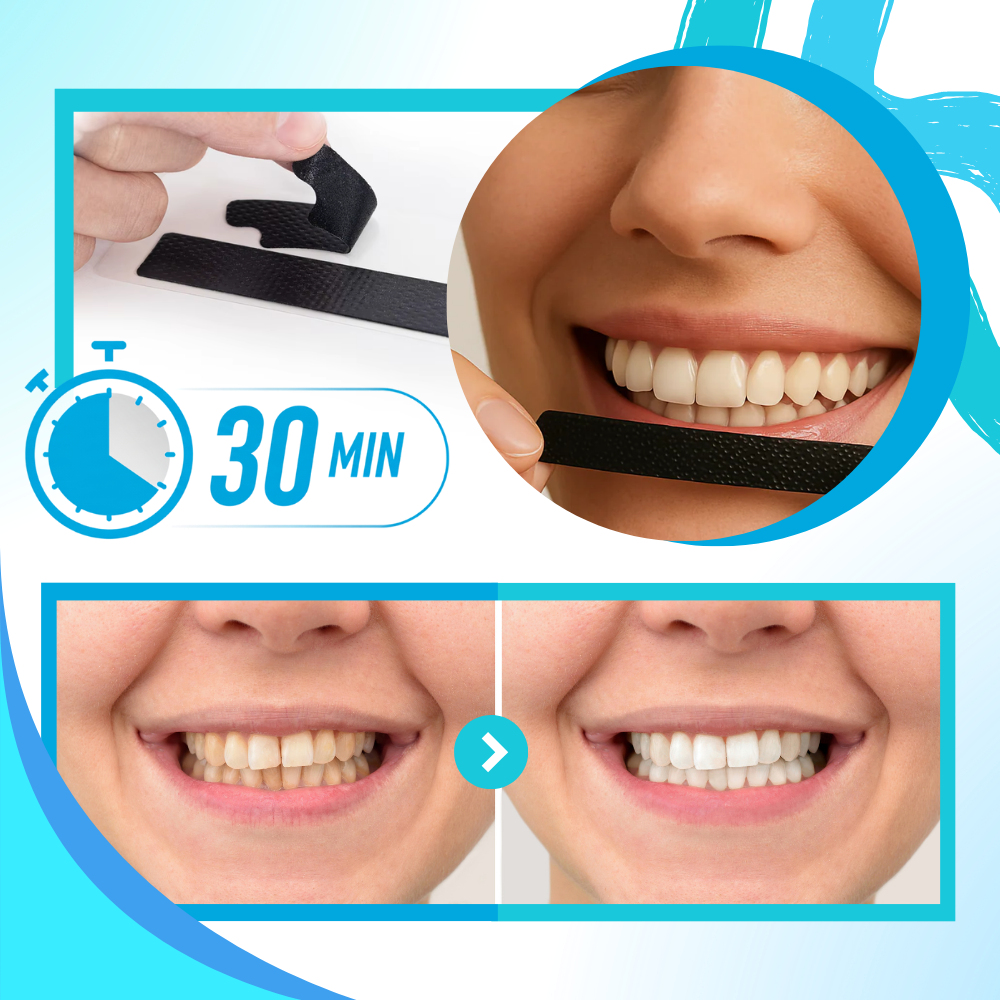 Tiras dentales de menta y carbón - Ozerty