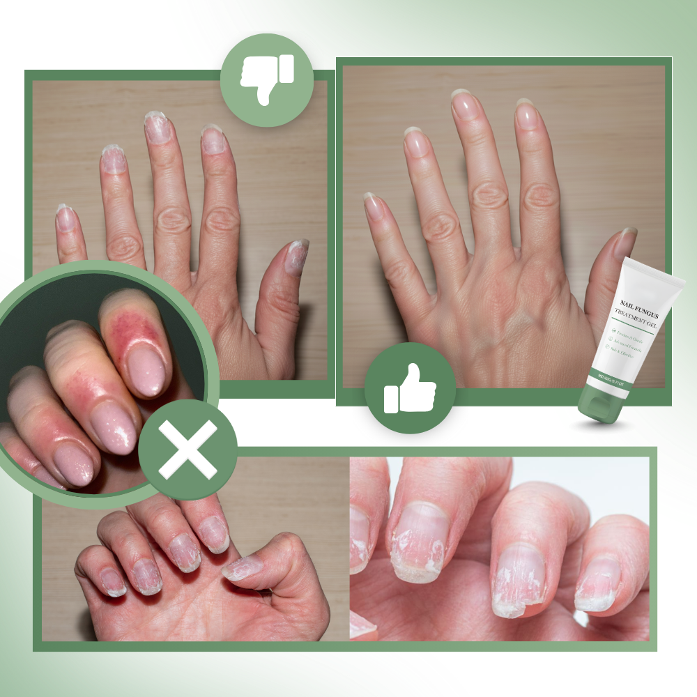 Gel revitalizante e hidratante para uñas - Ozerty