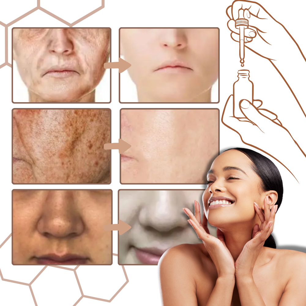 Sérum no graso y corrector de la melanina - Ozerty