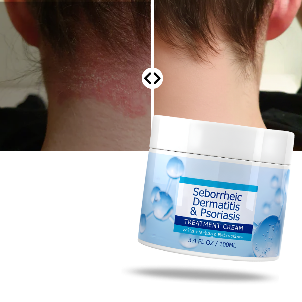 Crema hidratante para el cuidado del cuero cabelludo - Ozerty