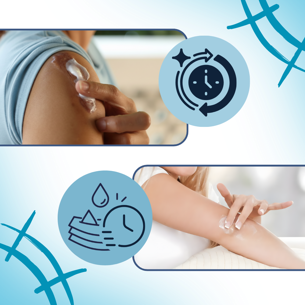 Crema hidratante con silicona para cicatrices - Ozerty