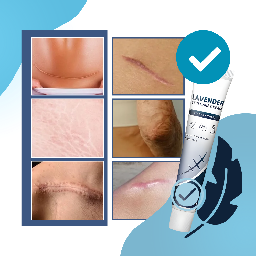 Crema hidratante con silicona para cicatrices - Ozerty