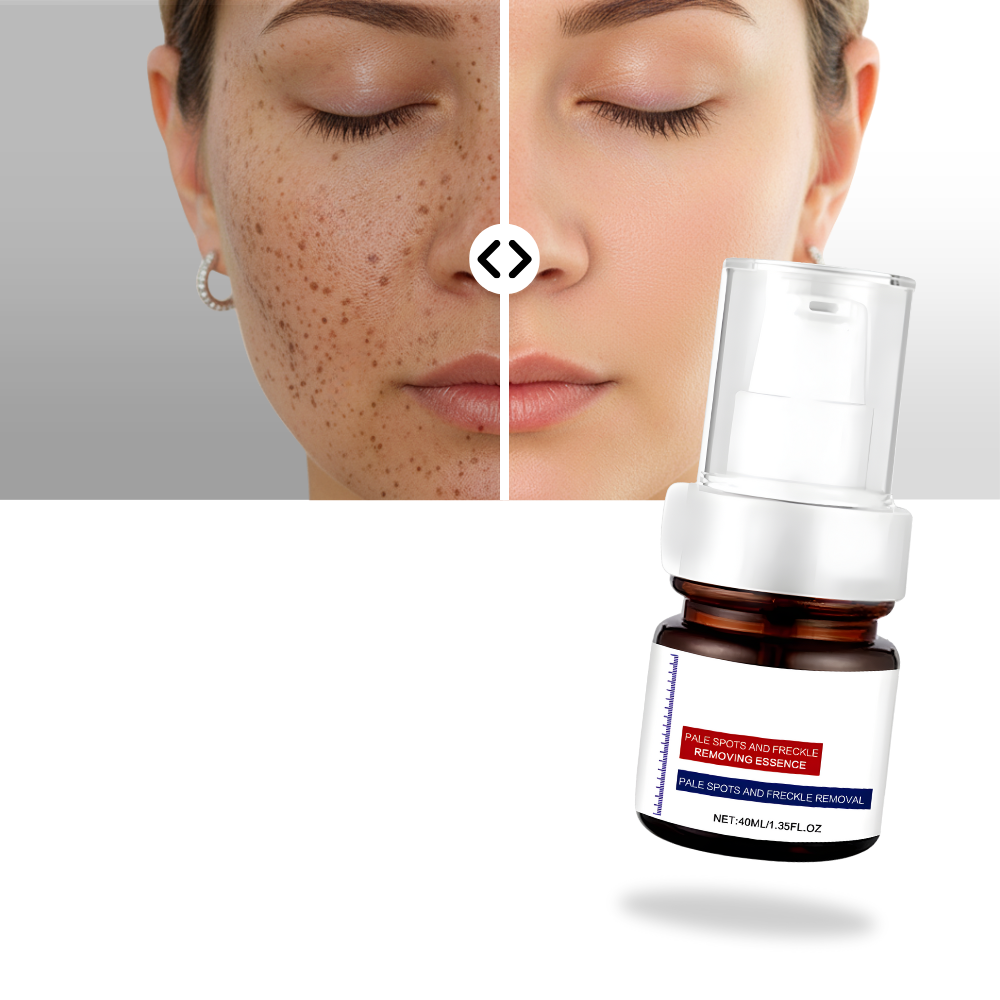 Suero kojic sedoso para iluminar la piel - Ozerty