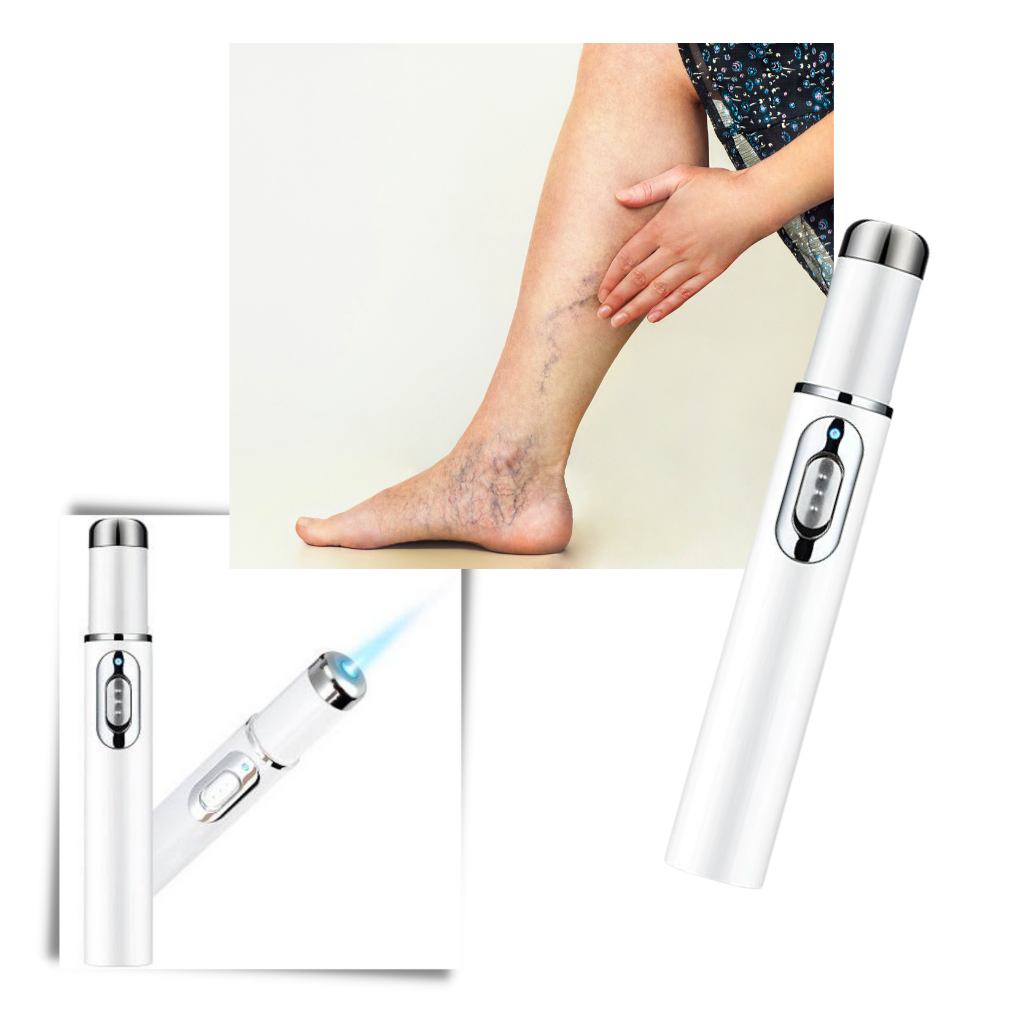 Bolígrafo de terapia cutánea con luz azul - Ozerty