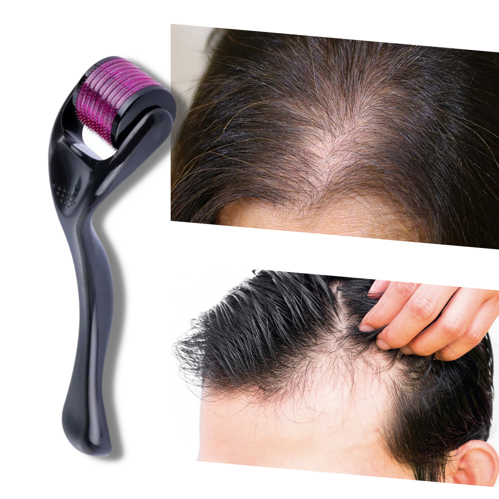 Rodillo Derma para el crecimiento del cabello y la barba - Ozerty