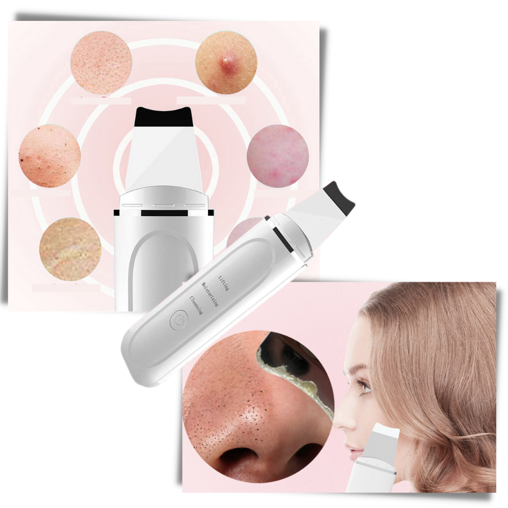 Exfoliante facial ultrasónico de limpieza profunda - Ozerty